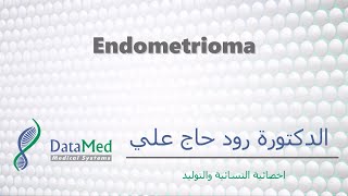 محاضرة دكتورة رود حاج علي Endometrioma [upl. by Adnuahsal]