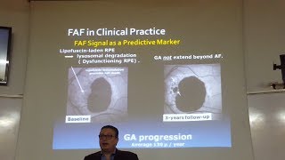 Fundus Auto Fluorescence Part 2 Prof Dr Karim Raafat [upl. by Ajet]