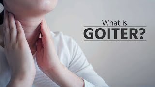 What is goiter  what is goiter disease  what is goiter thyroid  what is goiter symptoms [upl. by Avan]