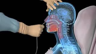 How to insert a nasogastric tube for NG intubation  3d animation [upl. by Valente]