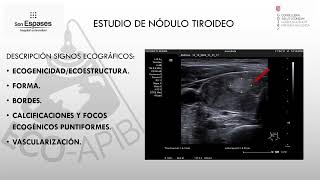 ECOGRAFÍA DE TIROIDES PARTE II ECOGRAFIA DEL NODULO TIROIDEO Y ADENOPATIAS DrArgüellesEndocrino [upl. by Annabela]