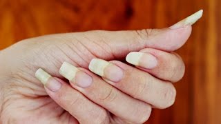 COMO FAZER SUAS UNHAS CRESCEREM MUITO EM POUCOS DIAS [upl. by Stearne]