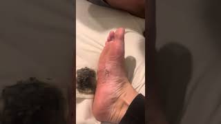 Detox foot pads [upl. by Loydie833]