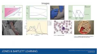 Respiratory Care Patient Assessment and Care Plan Development [upl. by Ardnyk682]