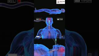 Liquid Ventilation Medical 3D Animation short [upl. by Seluj]