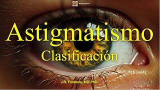 Clasificación del Astigmatismo [upl. by Meyers]