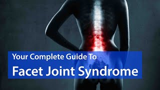 Is Facet Joint Syndrome Causing Your Back Pain EVERYTHING YOU SHOULD KNOW [upl. by Ttoile]