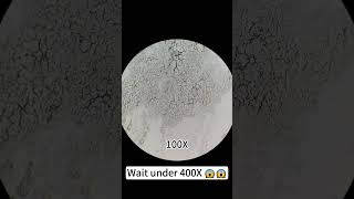 Pimples at 400X magnification are really cool underthemicroscope beefcut scienceshorts [upl. by Vivianna]