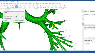 How to Quickly Segment Airways in Mimics  Mimics Innovation Suite  Materialise Medical [upl. by Leahcym78]