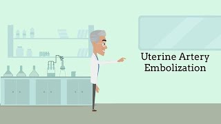 Uterine Fibroid Embolization Fibroids No Surgery Required [upl. by Miko]