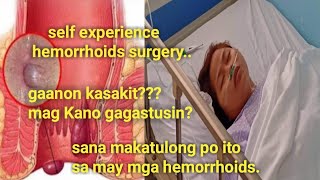 hemorrhoidectomy surgery Gaano kasakit magkano Ang gastos [upl. by Parcel532]