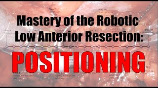 Robotic Low Anterior Resection Patient Positioning and Room Setup [upl. by Mirilla]