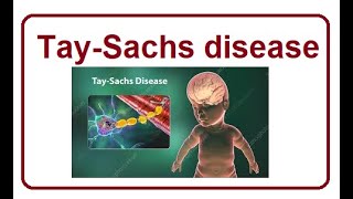 Tay Sachs Disease Symptom  2024 [upl. by Akeit]