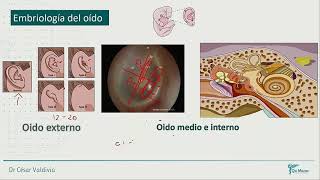 Otorrinolaringología  Dr Cesar Valdivia Parte 1 [upl. by Aihppa]