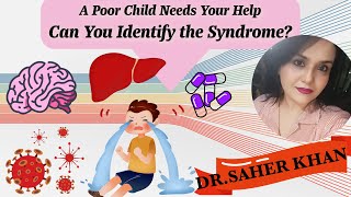 Can You Identify the Syndrome This Child is Suffering from Encephalopathy and Liver Damage [upl. by Heman911]