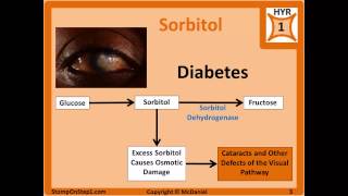 PKU Phenylketonuria Galactosemia Hereditary Fructose Intolerance amp Sorbitol Diabetic Cataracts [upl. by Novj93]