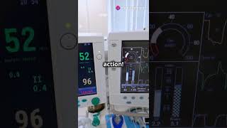 PRVC Mode in Ventilators Explained in 60 Seconds [upl. by Frodi]