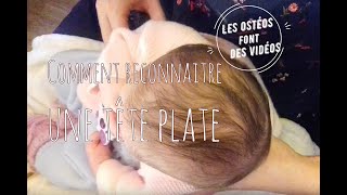 Comment reconnaitre une déformatione crânienne du bébé plagiocéphalie  brachycéphalie  tête plate [upl. by Ayotac]