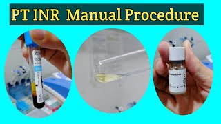 PT INR Manual Procedure Prothrombin Time Test PT Manual Test PT Manual Procedure in Urdu amp Hindi [upl. by Retsbew]