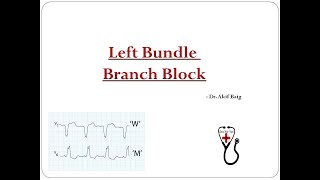 Left Bundle Branch block  Dr Akif Baig [upl. by Eibur]