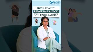 Dealing with dark necks and underarms 💡KlaraSkinandHairClinic Velachery Alwarpet [upl. by Frame]