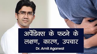 Appendix Pain Symptoms Treatment अपेंडिक्स क्या है इसके दर्द की पहचान कैसे करें कैसे करें इलाज [upl. by Hazel]