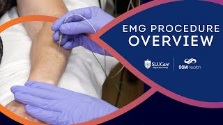 The EMG Procedure Overview of the Nerve Conduction Study Process [upl. by Fedirko604]