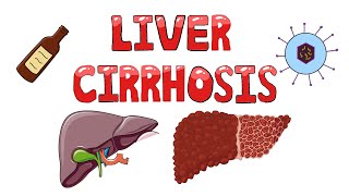 Liver Cirrhosis  What happens in Liver Cirrhosis  Pathophysiology Causes Signs amp Symptoms [upl. by Neelcaj]