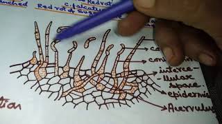 Colletotrichum in Hindi Red rot of sugarcane [upl. by Nwahsyar271]