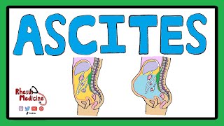 ASCITES  Serum Ascites Albumin Gradient SAAG  Ascites Pathophysiology  Ascites Causes [upl. by Jahdol205]