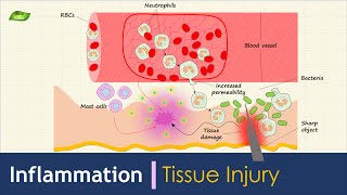 Inflammation in injury  Basic Science Series [upl. by Lukas537]