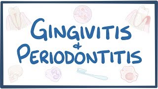 Gingivitis and periodontitis  causes symptoms diagnosis treatment pathology [upl. by Celestina]