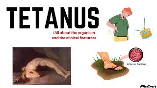 Tetanus  Part 1  In just 10 minutes  Medinare [upl. by Shull]