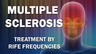 Multiple Sclerosis  RIFE Frequencies Treatment  Energy amp Quantum Medicine with Bioresonance [upl. by Yedrahs267]