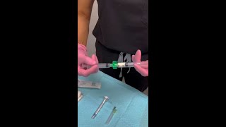 Radiesse Filler in the Hands [upl. by Cruz]