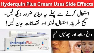 Hyderquin Plus Cream Uses In Urdu  Hyderquin Plus Cream Side Effects [upl. by Nitsej]