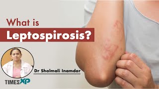 What Is Leptospirosis amp Zoonotic Diseases  Doctors Advice  TimesXP [upl. by Noelopan]