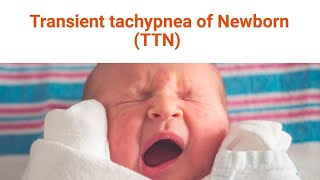 Transient Tachypnea of the Newborn [upl. by Ahcsat]