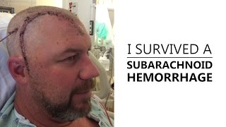 I Survived A Subarachnoid Hemorrhage [upl. by Raclima]