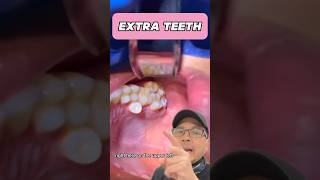 Should You Remove Your Extra Tooth Dentist EXPLAINS  View Mobile Dental shorts [upl. by Stolzer]