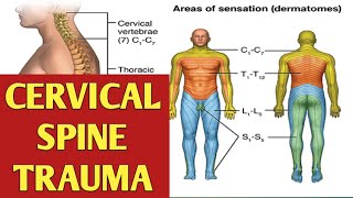 Cervical Spinal Injury  Cervical Spine Trauma  QUADRIPLEGIA AND ITS MANAGEMENT [upl. by Trista]