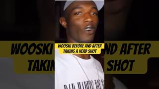 FBG Wooski Shows His Face After Getting Shot In The Head At A FUNERAL [upl. by End]