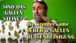 Wundersame Leber und Gallenblasenreinigung SINN oder UNSINN [upl. by Adnot938]