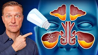 Rid Throat and Sinus Mucus with SALT [upl. by Lachlan]