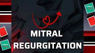 MITRAL VALVE REGURGITATION [upl. by Yecnahc]