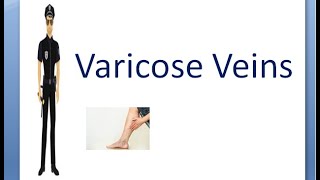 Surgery 136 Varicose Veins Case Presentation History Taking format viva questions clinical treat [upl. by Nesta582]