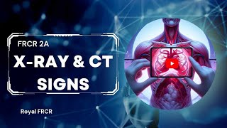 2  Chest Imaging for FRCR [upl. by Nosidam779]