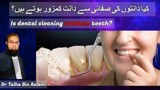 Teeth cleaning Teeth scaling Good or bad By Dr Talha Bin Aslam [upl. by Anytsirk]