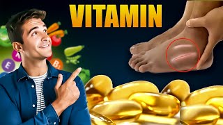 Vitamin to Eliminate Swelling in Feet and Leg [upl. by Yllrebmik]