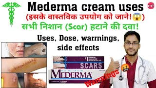 Mederma creammederma cream for acne scarmederma advance plus creammederma cream uses medicinetalk [upl. by Notxap933]